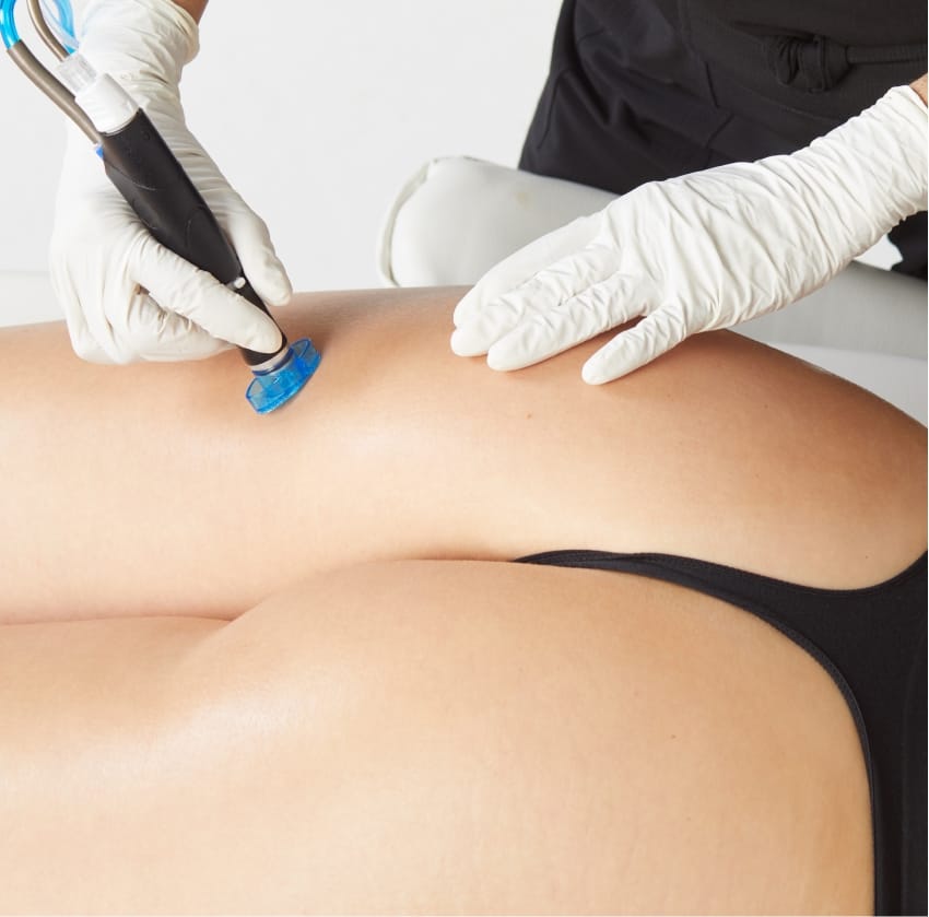 Hydrafacial Syndeo терапия за тяло