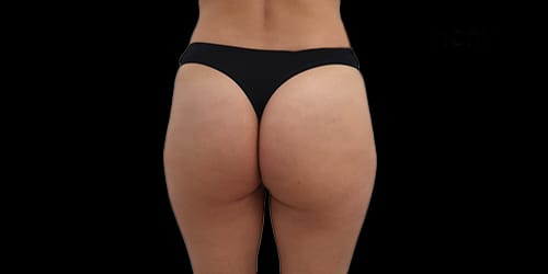 Lanluma after